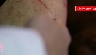  تصاویر دلخراش از زخم های وحشتناک اغتشاگران بر روی بدن کشته‌شدگان +  توضیحات پزشک و کارشناس اسلحه